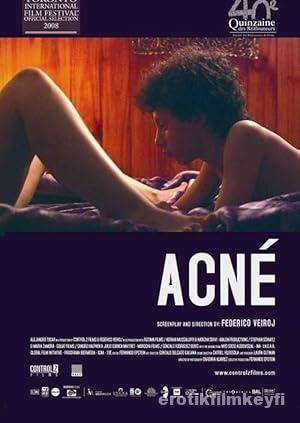 Acne 2008 izle